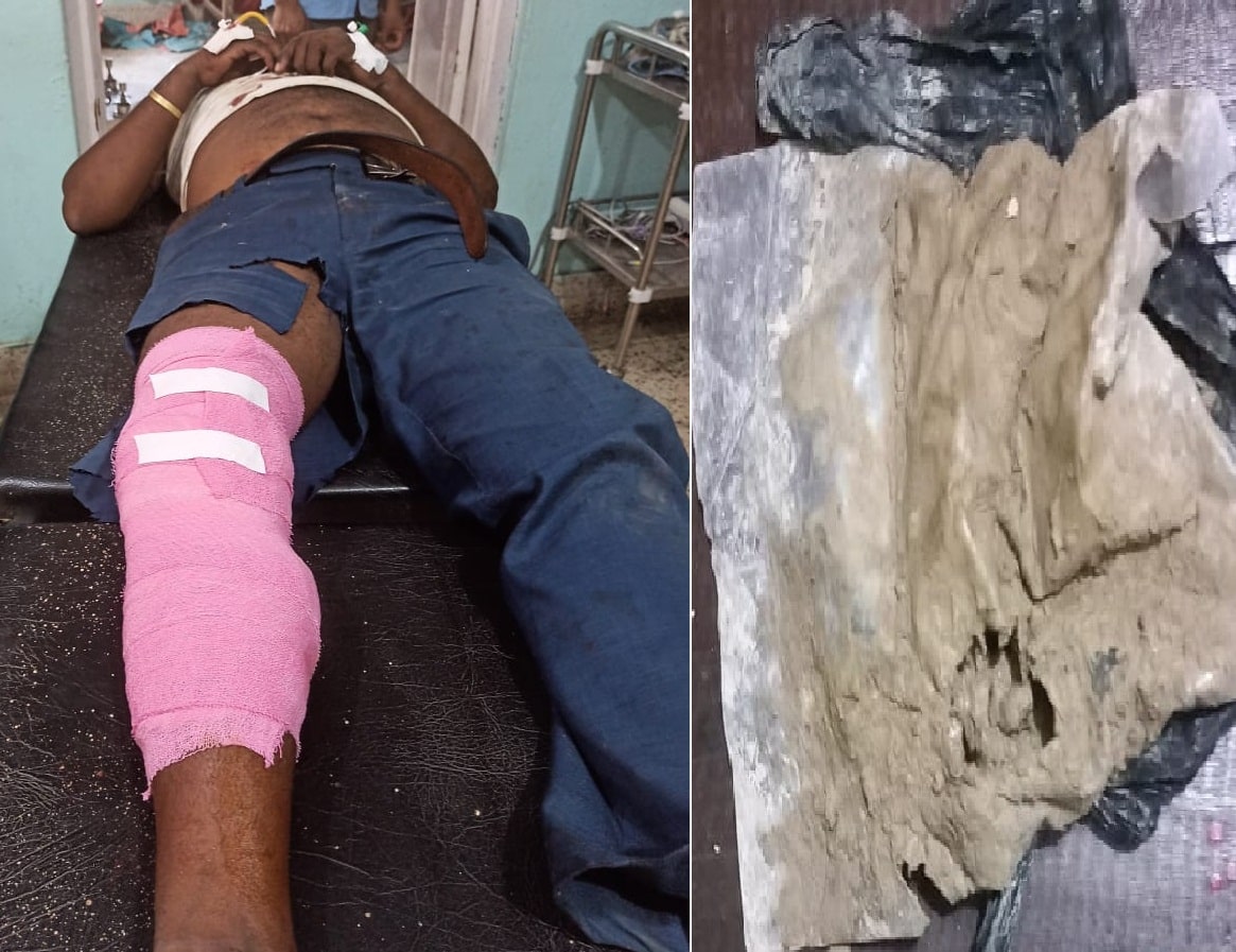 You are currently viewing लागूऔषध ओसार पसार गर्ने भारतिय नागरीकलाई गोली प्रहार गरी पक्राउ